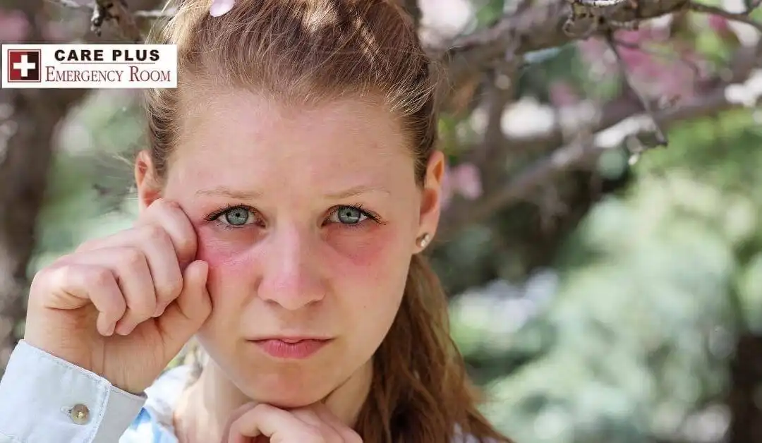 Pediatrics – Allergies