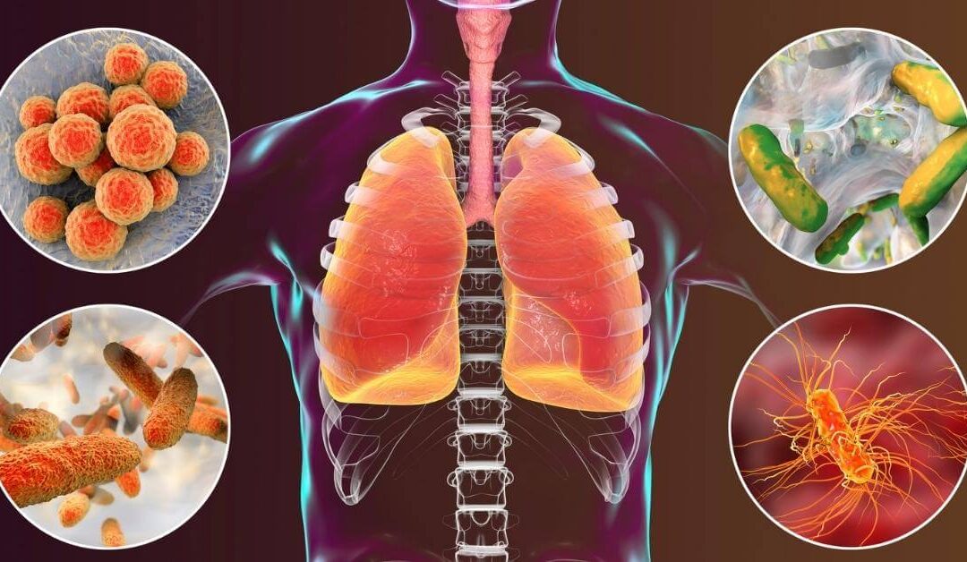 Pneumonia