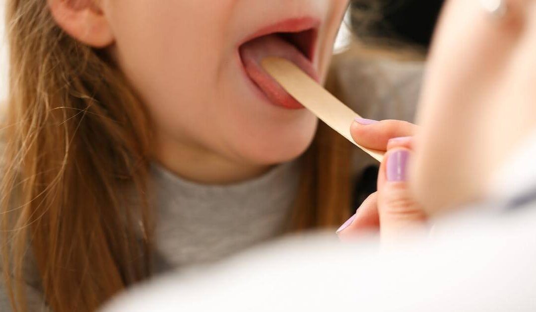 Strep Throat