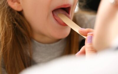 Strep Throat