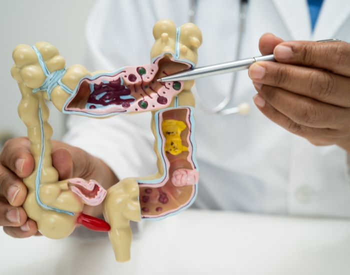 symptoms of appendicitis rupture