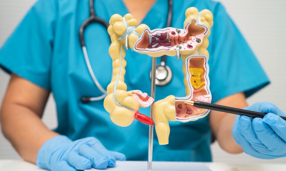 Appendix Rupture Symptoms: Signs of a Burst Appendix